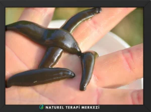 Tıbbi sülüklerin (Hirudo medicalis) yakından görünümü - Doğal tedavi ve hirudoterapi için kullanılan sağlıklı sülükler | Naturel Terapi Merkezi